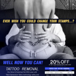 New Tattoo removal flyer